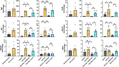 Heat shock protein 90 inhibition attenuates inflammation in models of atopic dermatitis: a novel mechanism of action